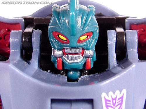 Overbite